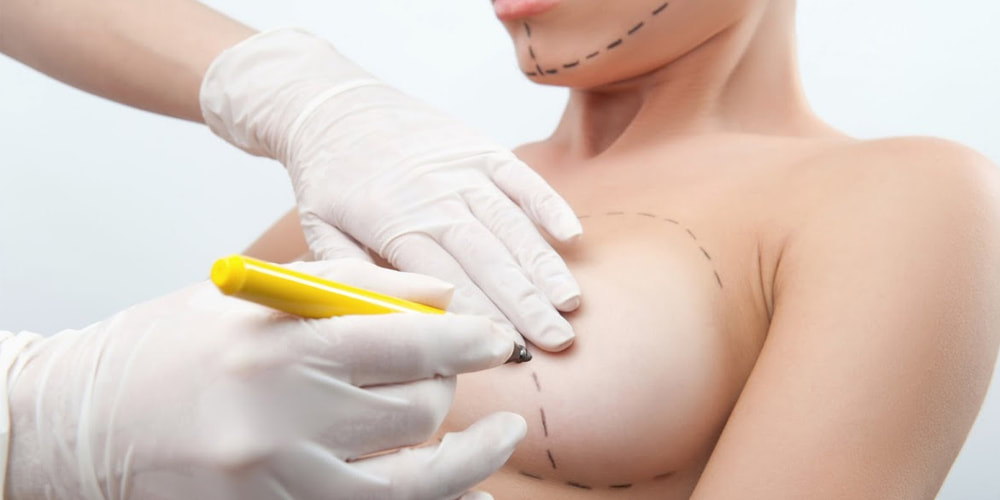 Breast Implant Options in Las Vegas & Henderson, NV